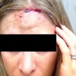 Agresión a pedradas en Caravaca