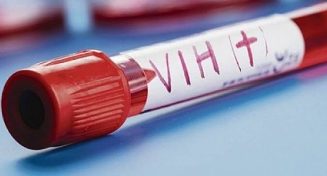segundo caso de remisión do VIH en todo o mundo