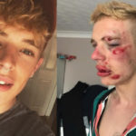 Homophobic attack on a boy of 22 years in the United Kingdom