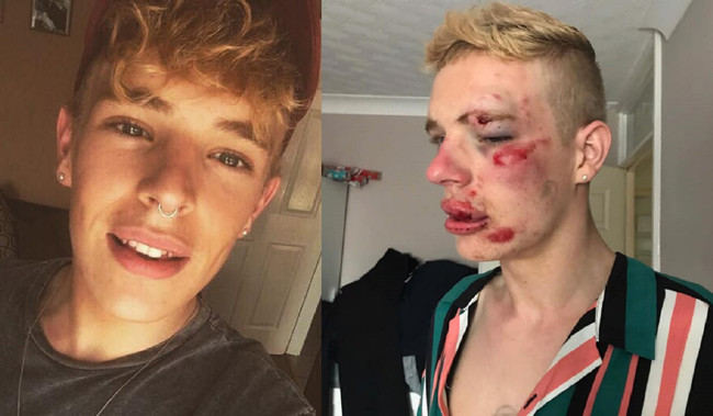 Brutal beating a boy of 22 years in the United Kingdom