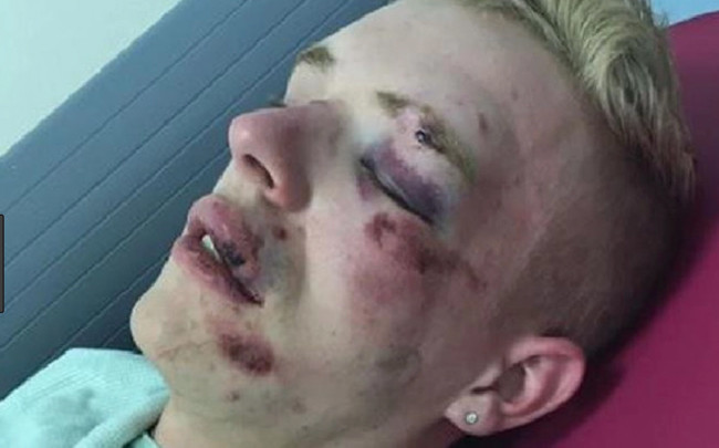 Brutale Prügel gegen einen 22-jährigen Jungen im Vereinigten Königreich