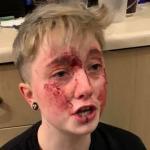 É a quinta vez que esta jovem de 20 anos é agredida por ser lésbica