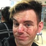 Brutal beating a hetero for defending his gay friends
