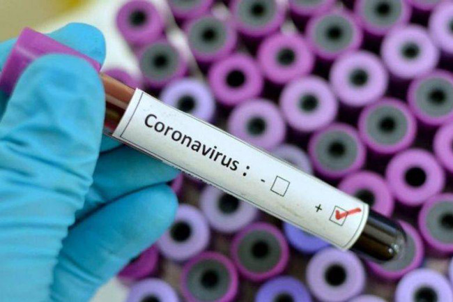 LGTB + people are at higher risk of contracting the coronavirus