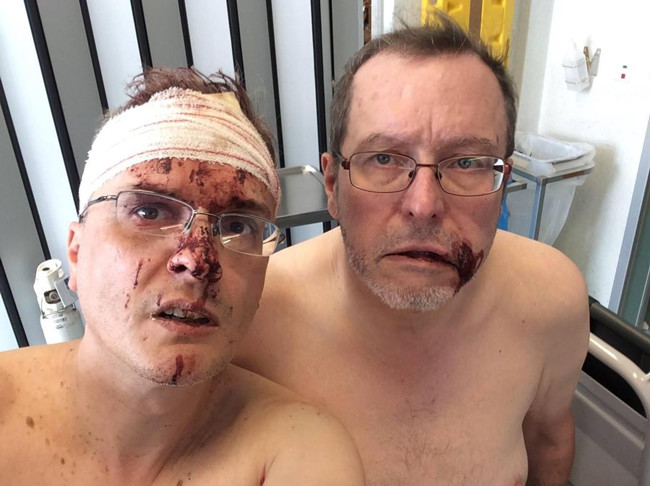 Homophobic neighbors brutally attack gay couple in Belgium