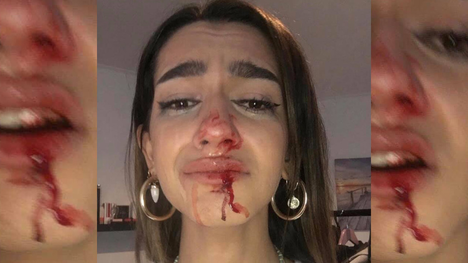 Brutal assault on a trans woman in Barcelona