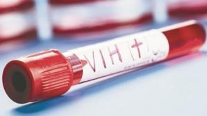 Die WHO warnt davor, dass 12 Millionen Menschen mit HIV keine Behandlung erhalten