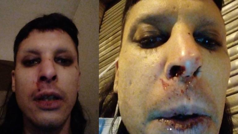 They accuse four neighbors of brutally attacking a trans woman and her partner in Barcelona
