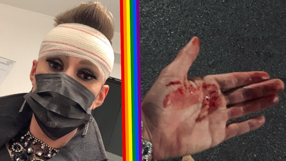 Ein junger Mann wurde in Eixample verletzt, nachdem er von einer homophoben Gruppe angegriffen wurde