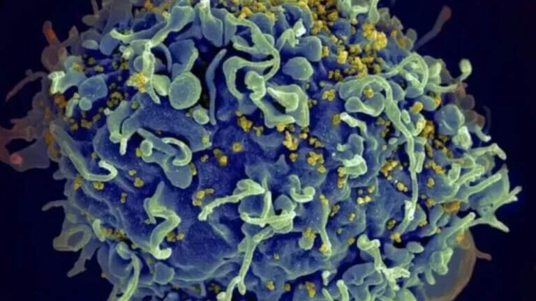 They discover a new variant of HIV more virulent and contagious