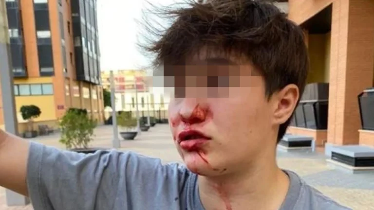 Homophobic aggression in Alicante: they beat up a minor shouting "maricona" and "transformer"