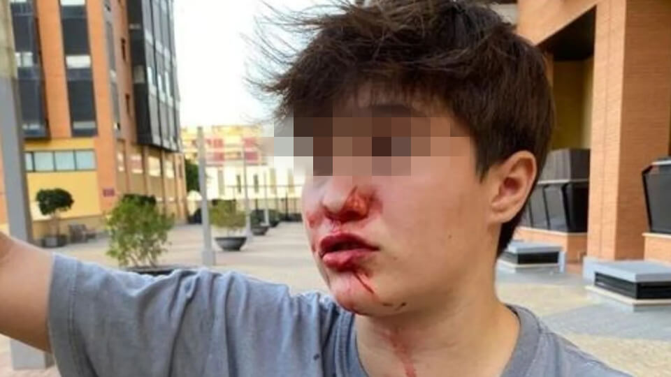 Aggressione omofobica ad Alicante: hanno picchiato un minorenne urlando "frocio" e "trasformatore"