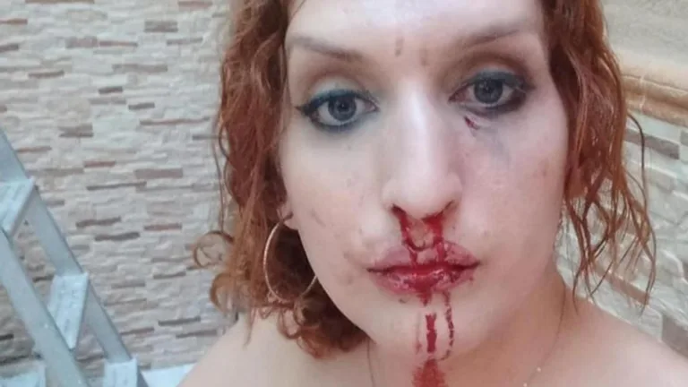 Three arrested for the transphobic attack on a young woman and her partner in Atarfe (Granada)